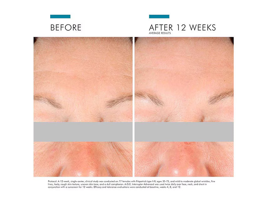 SkinCeuticals A.G.E. Interrupter Advanced | LSDC Pharmacy London