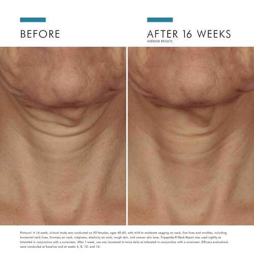 SkinCeuticals Tripeptide-R Neck Repair | LSDC Pharmacy London