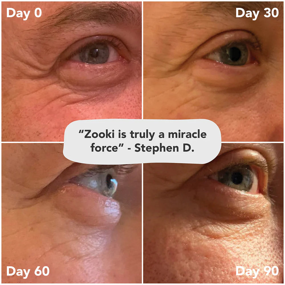 Collagen Zooki 5000mg Berry 15ml sachet
