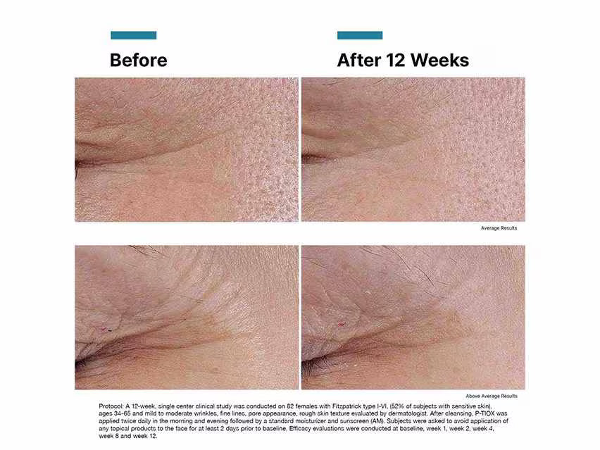 SkinCeuticals P-TIOX 30ml | Peptide Anti-Wrinkle Serum | LSDC Pharmacy London