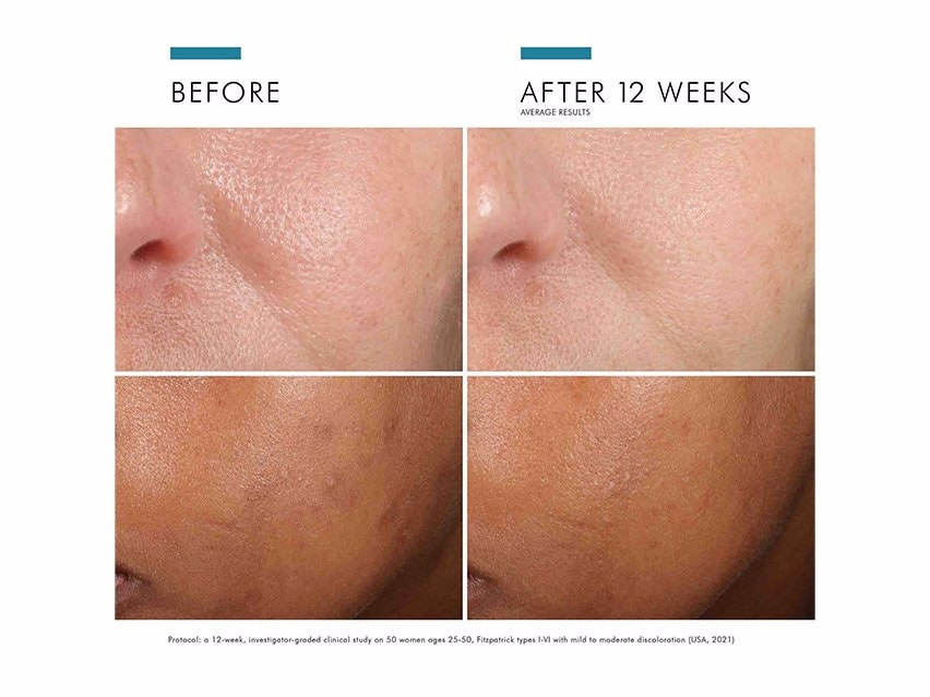 SkinCeuticals Phloretin CF 15ml | LSDC Pharmacy London