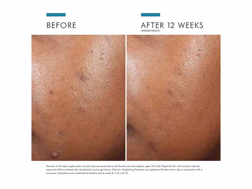 SkinCeuticals Phyto A+ Brightening Treatment 30ml | LSDC Pharmacy London