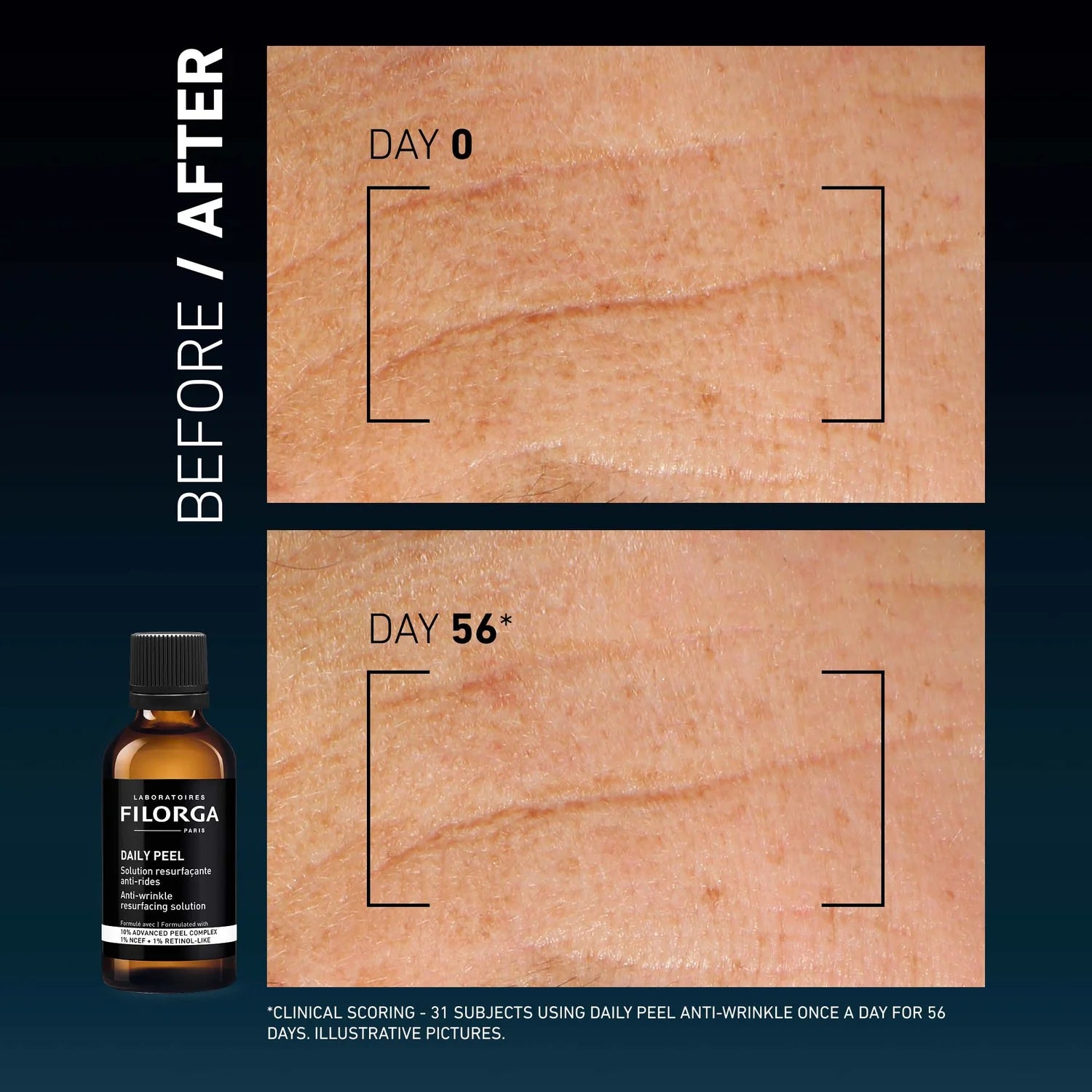 Filorga Daily Peel Anti-Wrinkle 