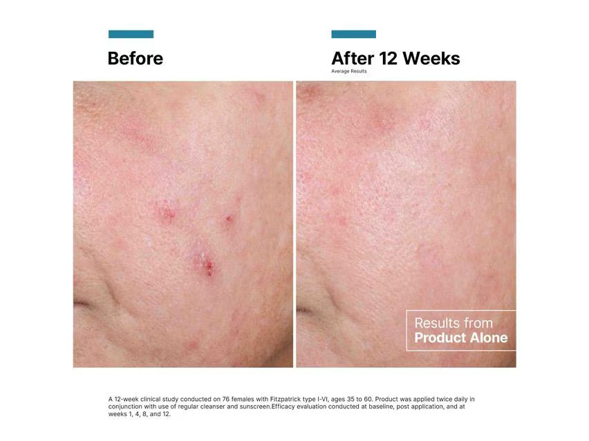 SkinCeuticals Advanced RGN-6 120ml | LSDC Pharmacy London