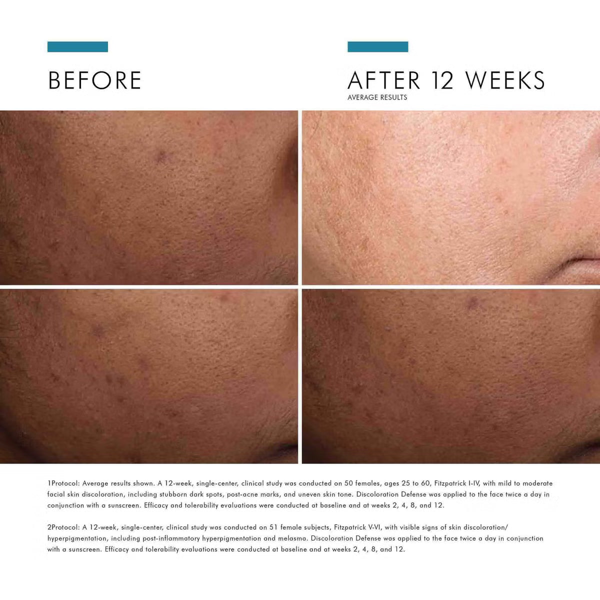 Discoloration Defense Serum 30ml | LSDC Pharmacy London