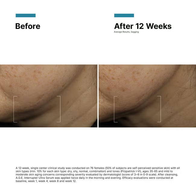 A.G.E. Interrupter Ultra Serum | LSDC Pharmacy London