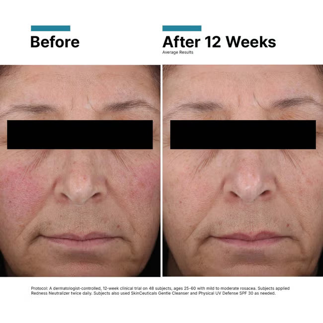 Redness Neutralizer 50ml | LSDC Pharmacy London