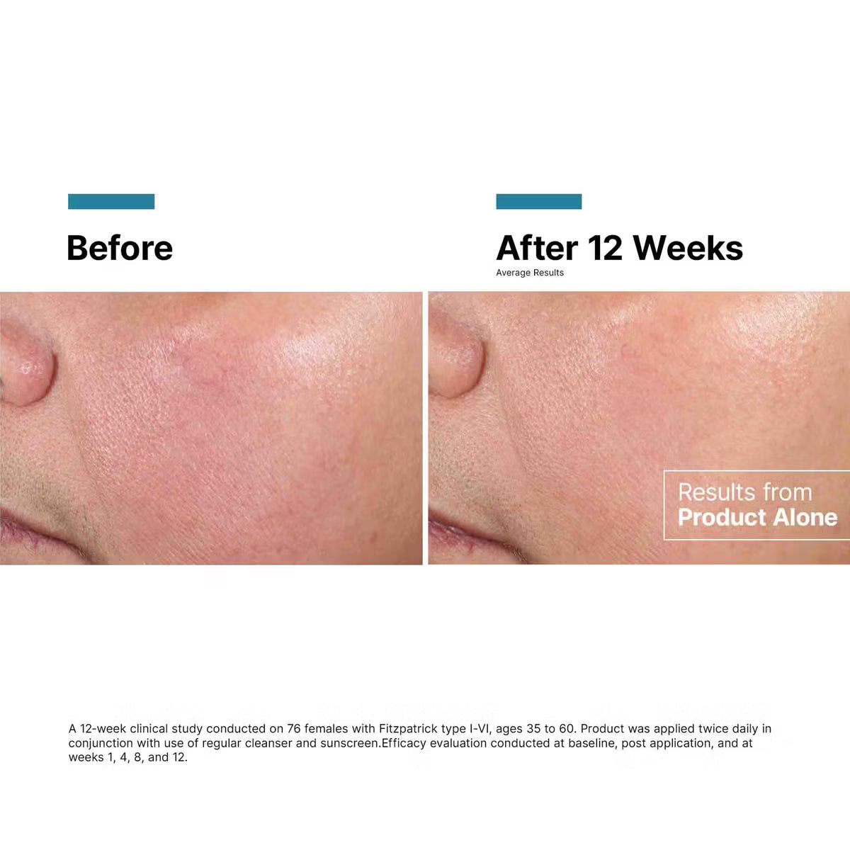 Advanced RGN-6 | LSDC Pharmacy London