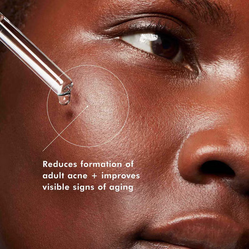 Blemish + Age Defense 30ml | LSDC Pharmacy London