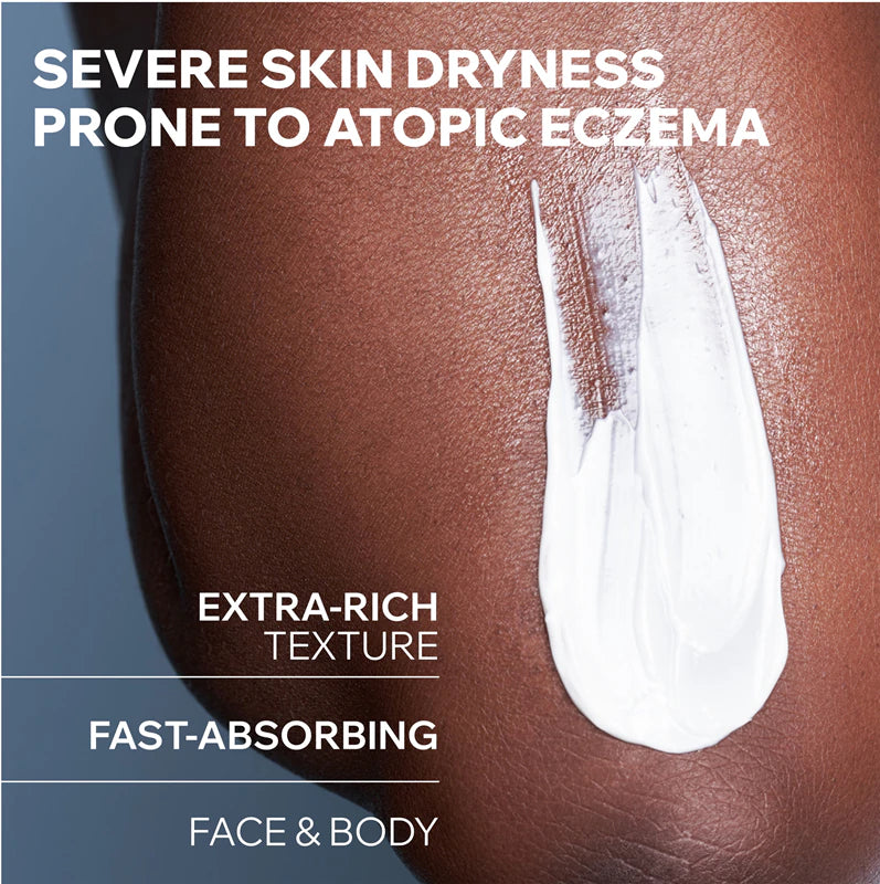 Uriage demise lipid replenishing anti-itch cerat 200ml | Dry Skin Care | LSDC Pharmacy London